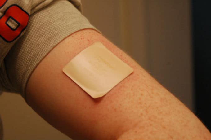 What are transdermal patches